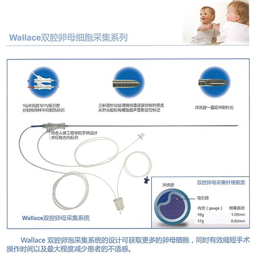 WALLACE 雙腔卵母細胞采集